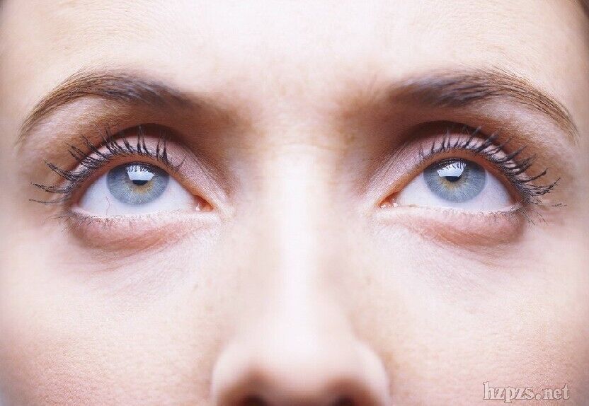 谁说眼袋甩不掉 避免这一些NG行为-中国化妆品